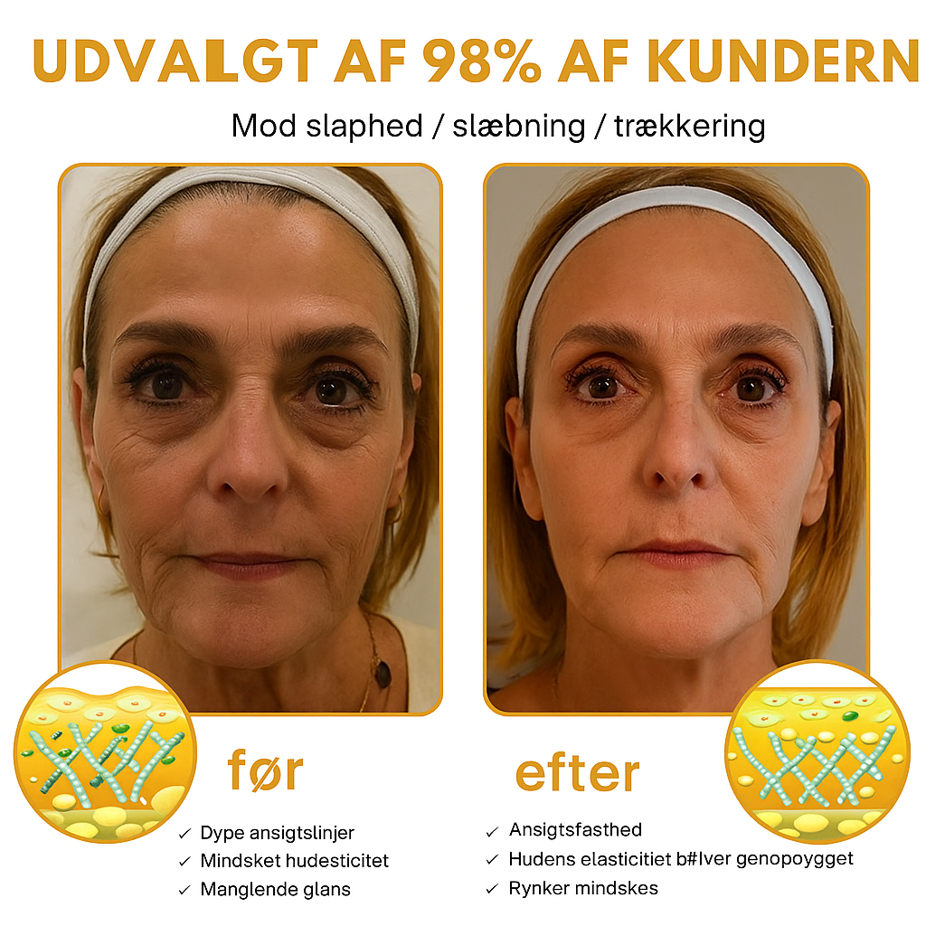 DermaLift™ - Botox Wrinkle Removal Cream