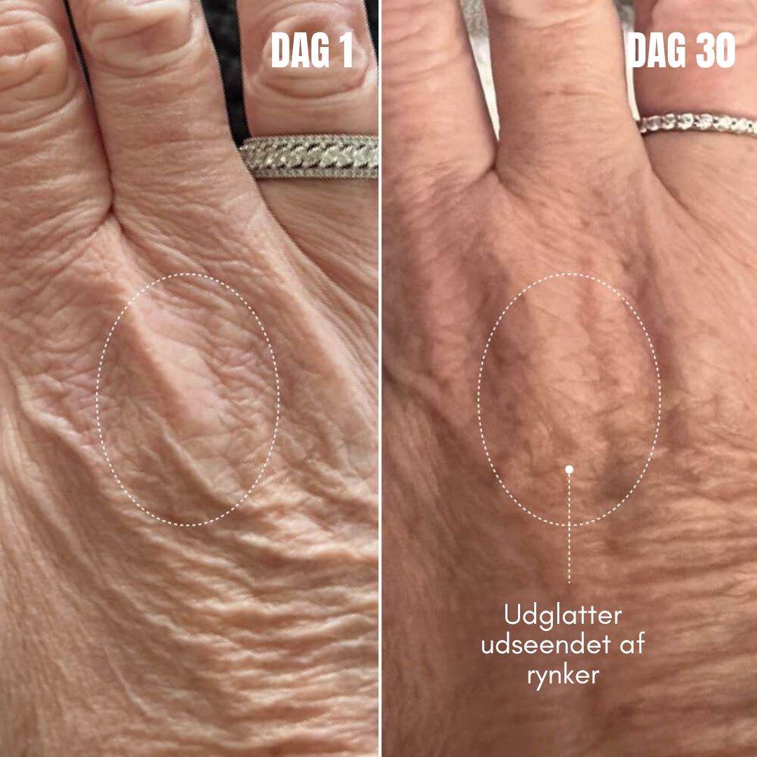 DermaLume™ - Opstrammende og udglattende serum til kroppen
