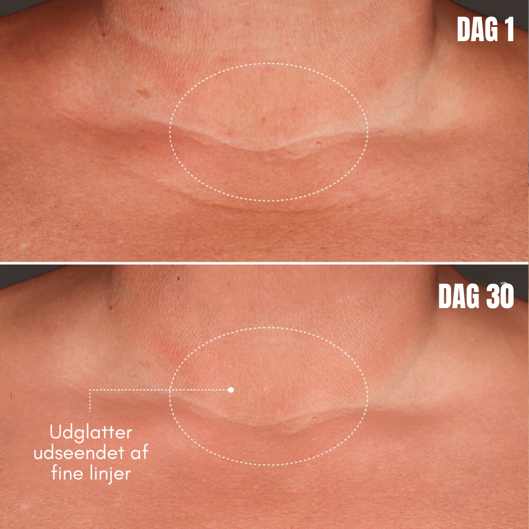 DermaLume™ - Opstrammende og udglattende serum til kroppen