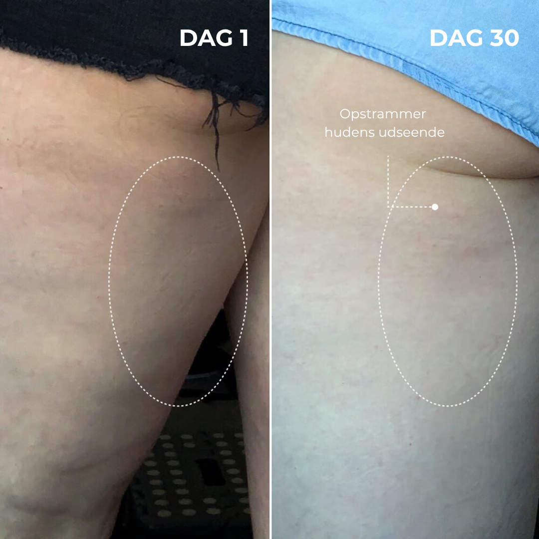 DermaLøft™ Opstrammende Numsemaske - Løfter og former bagdelen, mindsker appelsinhud og efterlader huden glat, fast og silkeblød