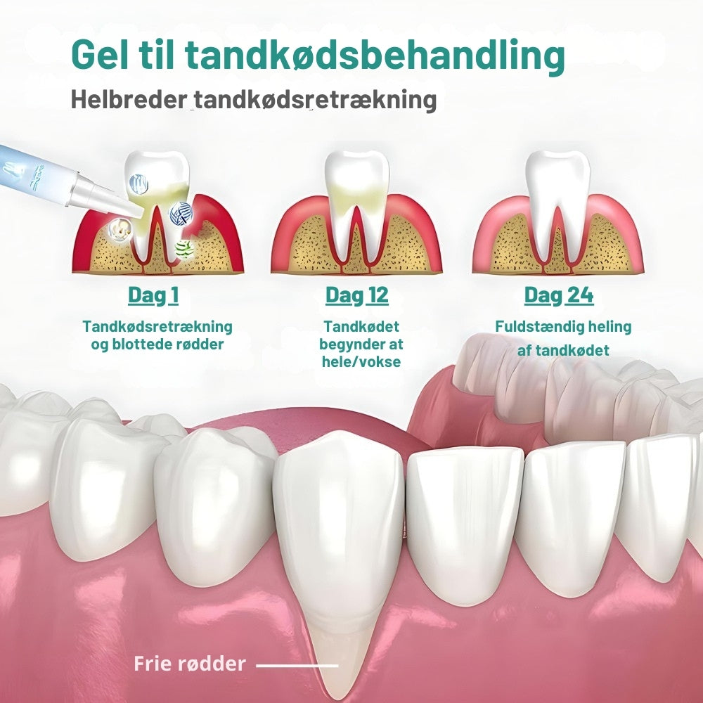 Oralis™ Tandgel – Gendan dit tandkød & få sundere, hvidere tænder på 7 dage