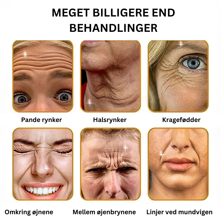 BOTOX™ Anti-rynke creme