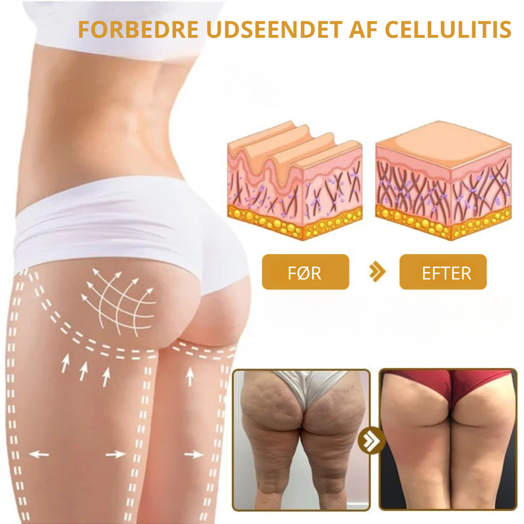 Venomé™| Botox Rynkeopstrammende Creme