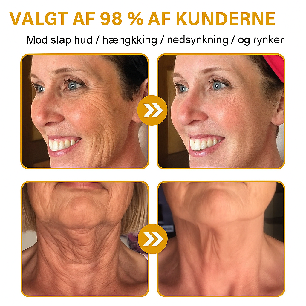 DermaLift™ - Botox Wrinkle Removal Cream
