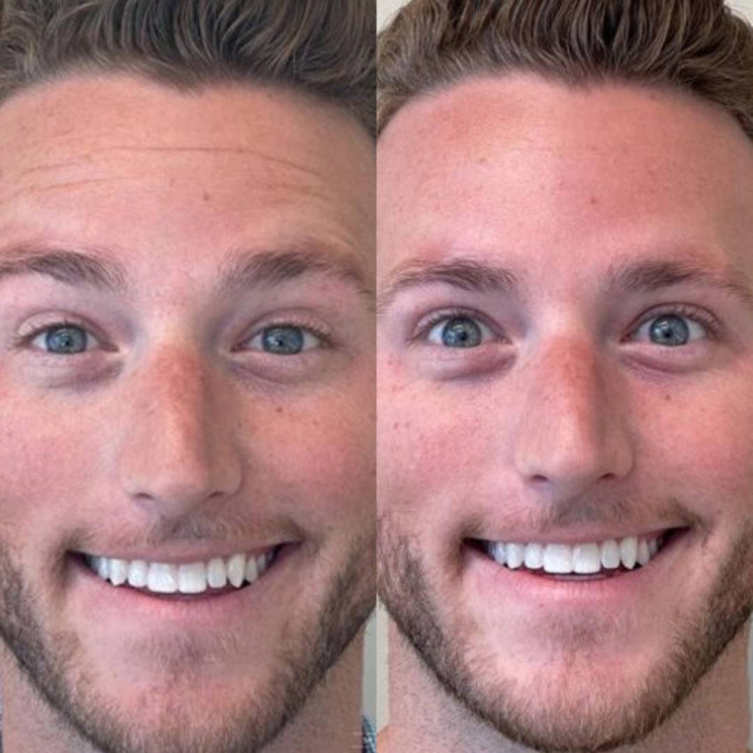 Nordisk Talg | Balm mod rynker til mænd | Naturlig løsning med synlig forskel på 14 dage