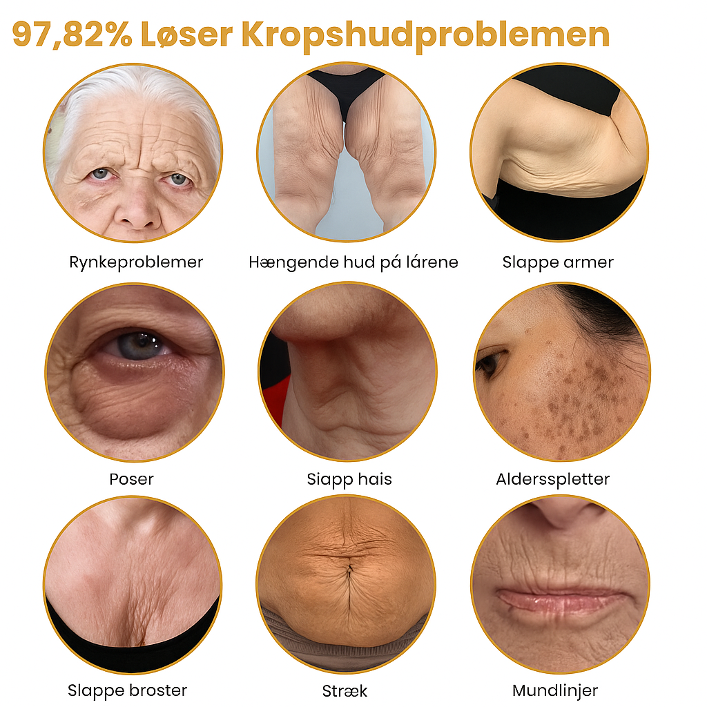 Venomé™| Botox Rynkeopstrammende Creme