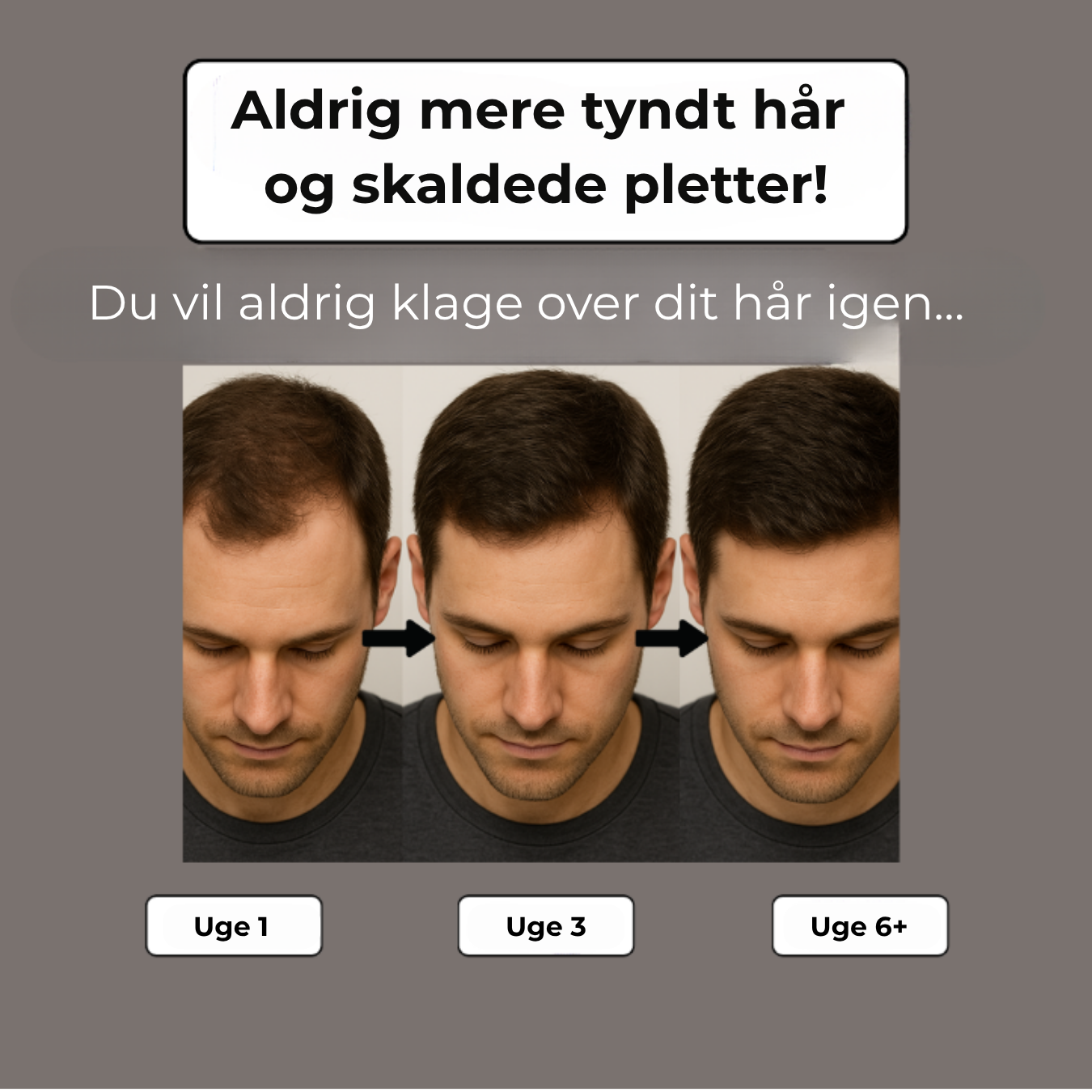 Helmvækst™ - Den 3-fasede planteshampoo mod hårtab