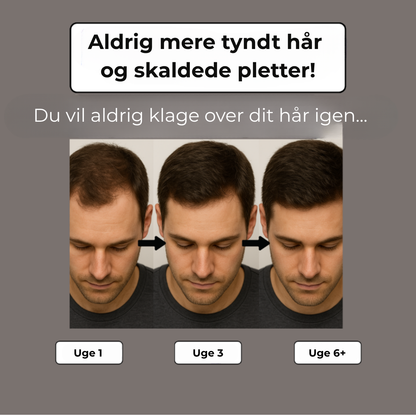 Helmvækst™ - Den 3-fasede planteshampoo mod hårtab