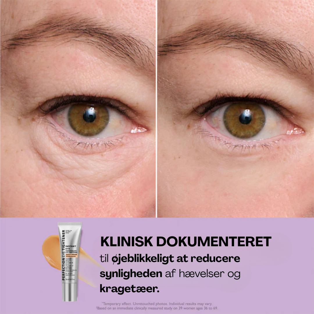 Øjeblikkelig Opstrammer™ | Øjenstrammer creme | Reducerer poser, hævelser og fine linjer på sekunder