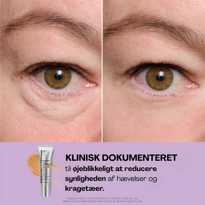 Øjeblikkelig Opstrammer™ | Øjenstrammer creme | Reducerer poser, hævelser og fine linjer på sekunder