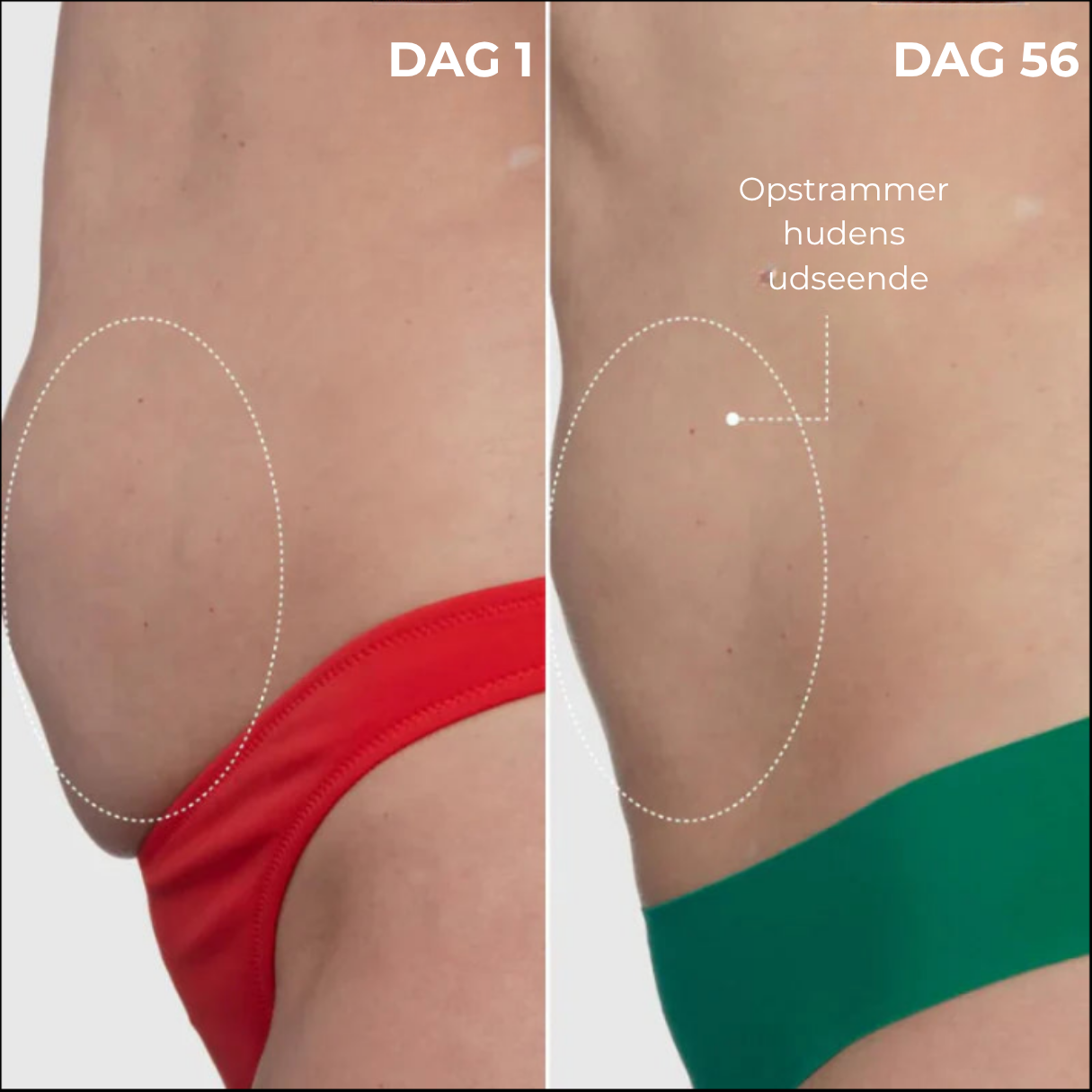 SleepShape™ - Luksuriøs kropswhip – for en fastere og glattere silhuet natten over