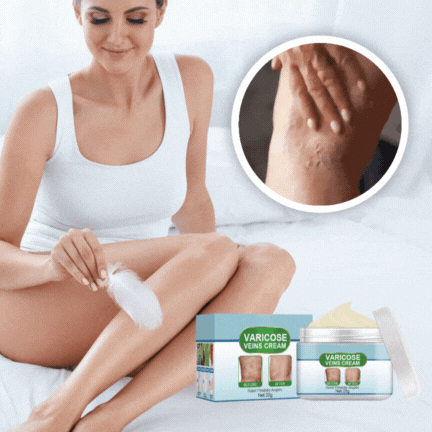 Venelys™ VenenKlar Creme – Reducerer synlige åreknuder og giver dig glatte, sunde ben på kun 7 dage!