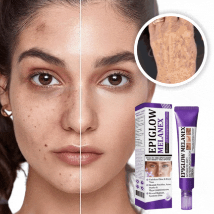 HudLys™ PigmentFix – Vis den hud, du tidligere skjulte – klar, strålende og fri for pigmentpletter på få dage!