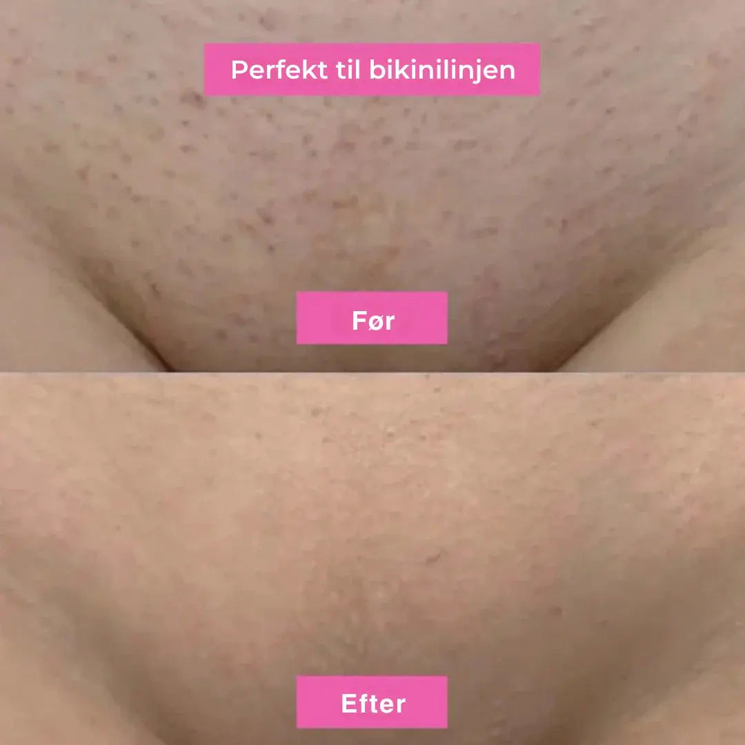 Glathud - Hårfjerningsolie – Naturligt glat hud uden barbering