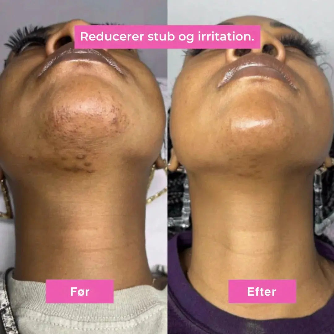 Glathud - Hårfjerningsolie – Naturligt glat hud uden barbering