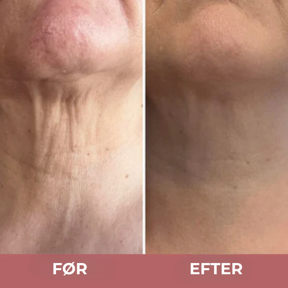 HalsLøft™ - Neck Sculpt Opstrammende Creme – Strammer op, Løfter og Genskaber Ungdommelig Hud