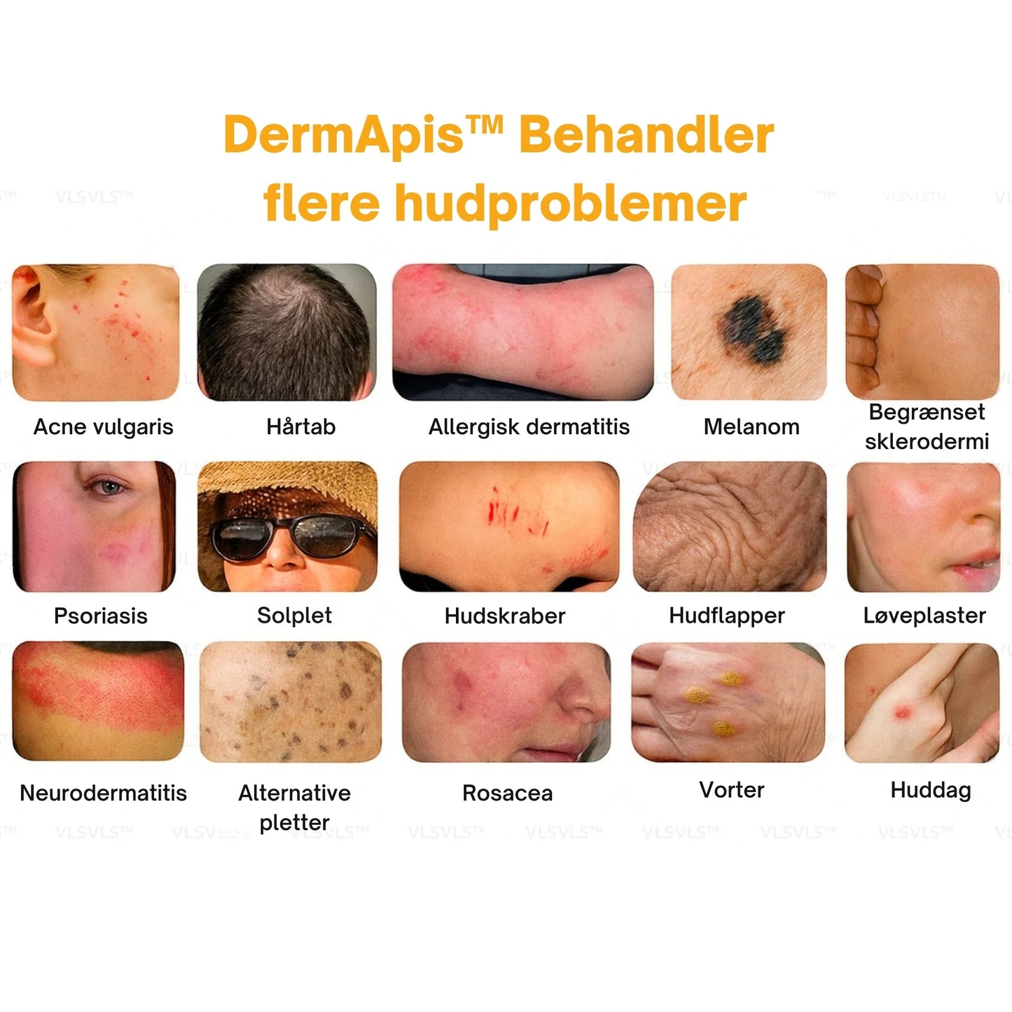 DermApis™ Hudcreme – Styrker skrøbelig hud & reducerer blå mærker