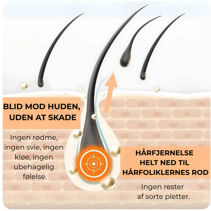 Joypretty™- Hormonel hårfjerning fjerner genstridigt ansigtshår på bare 4 dage!