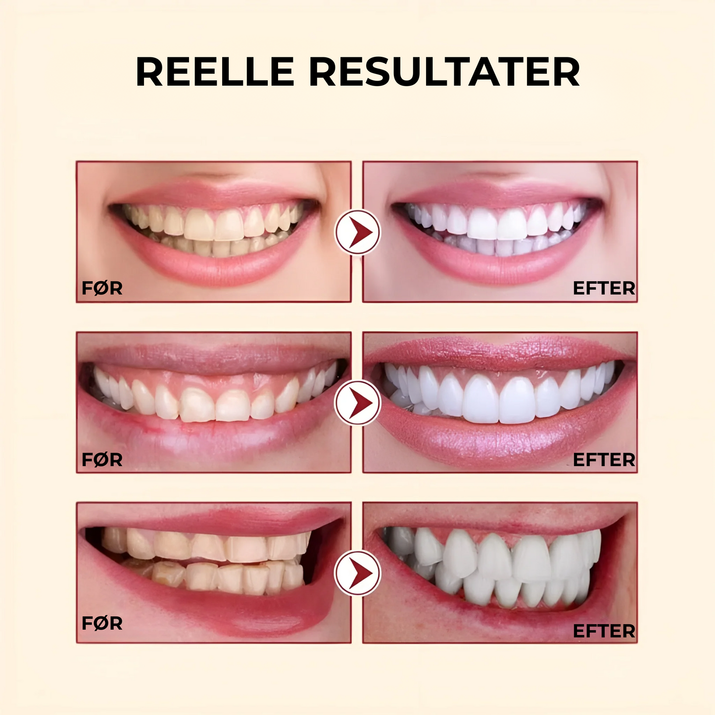 LysTand™ – Hemmeligheden bag et strålende smil.