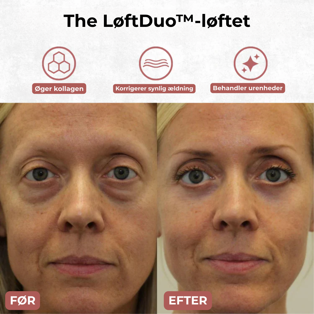 LøftDuo™ - Opstrammer både øjne og hals – med rød LED, sonisk massage og kølende roller for synligt glattere, yngre hud på få minutter