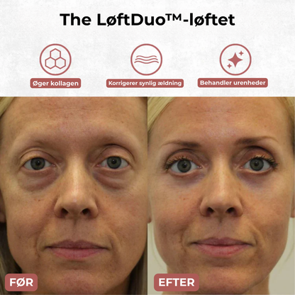 LøftDuo™ - Opstrammer både øjne og hals – med rød LED, sonisk massage og kølende roller for synligt glattere, yngre hud på få minutter