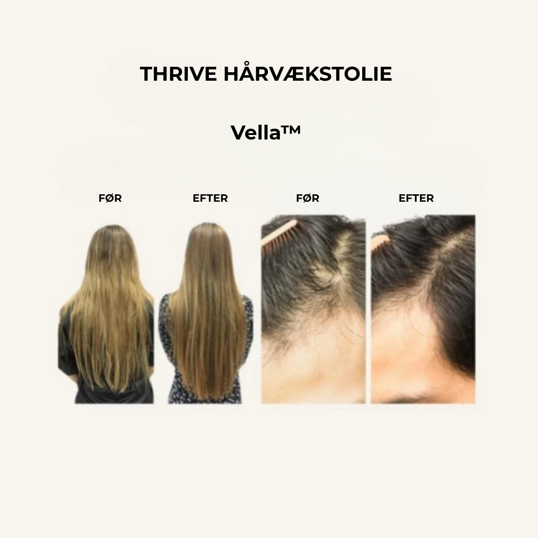 Vella™ – Naturlig hårolie mod hårtab og for stærkere vækst