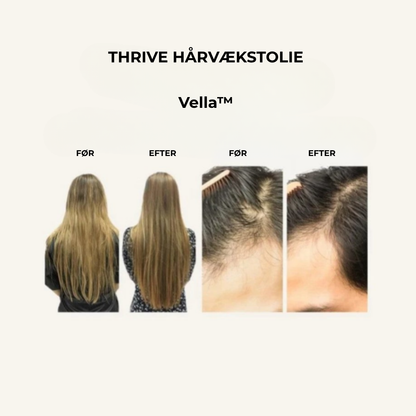 Vella™ – Naturlig hårolie mod hårtab og for stærkere vækst