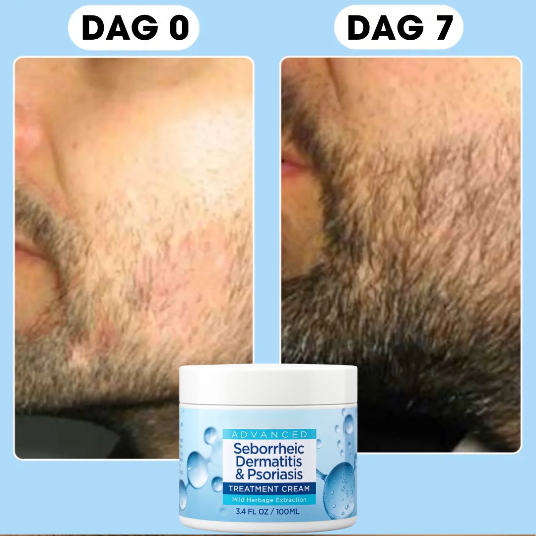 SkægRo™ | Beroligende skægbalm mod irritation