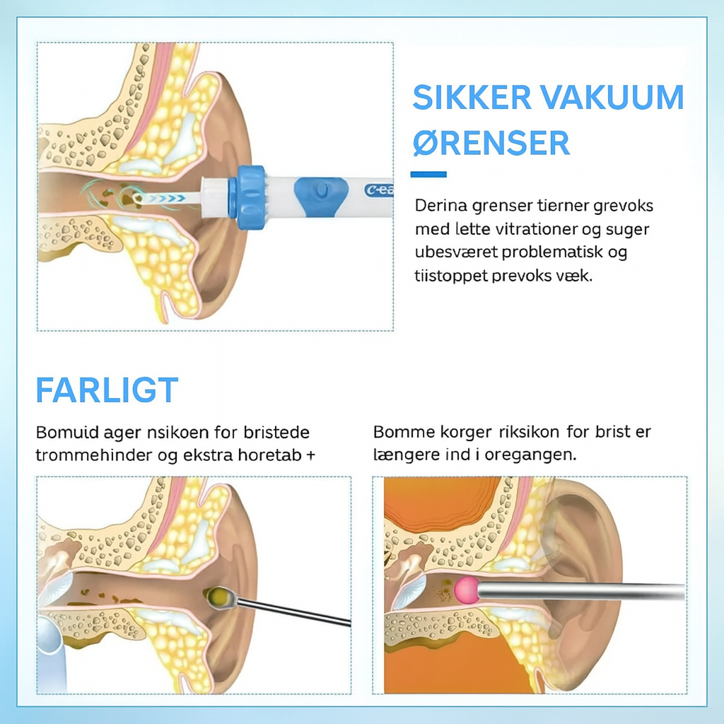 ØrevoksEase™ | Trådløs ørevoks fjerner | Blød og effektiv løsning til rens af øre