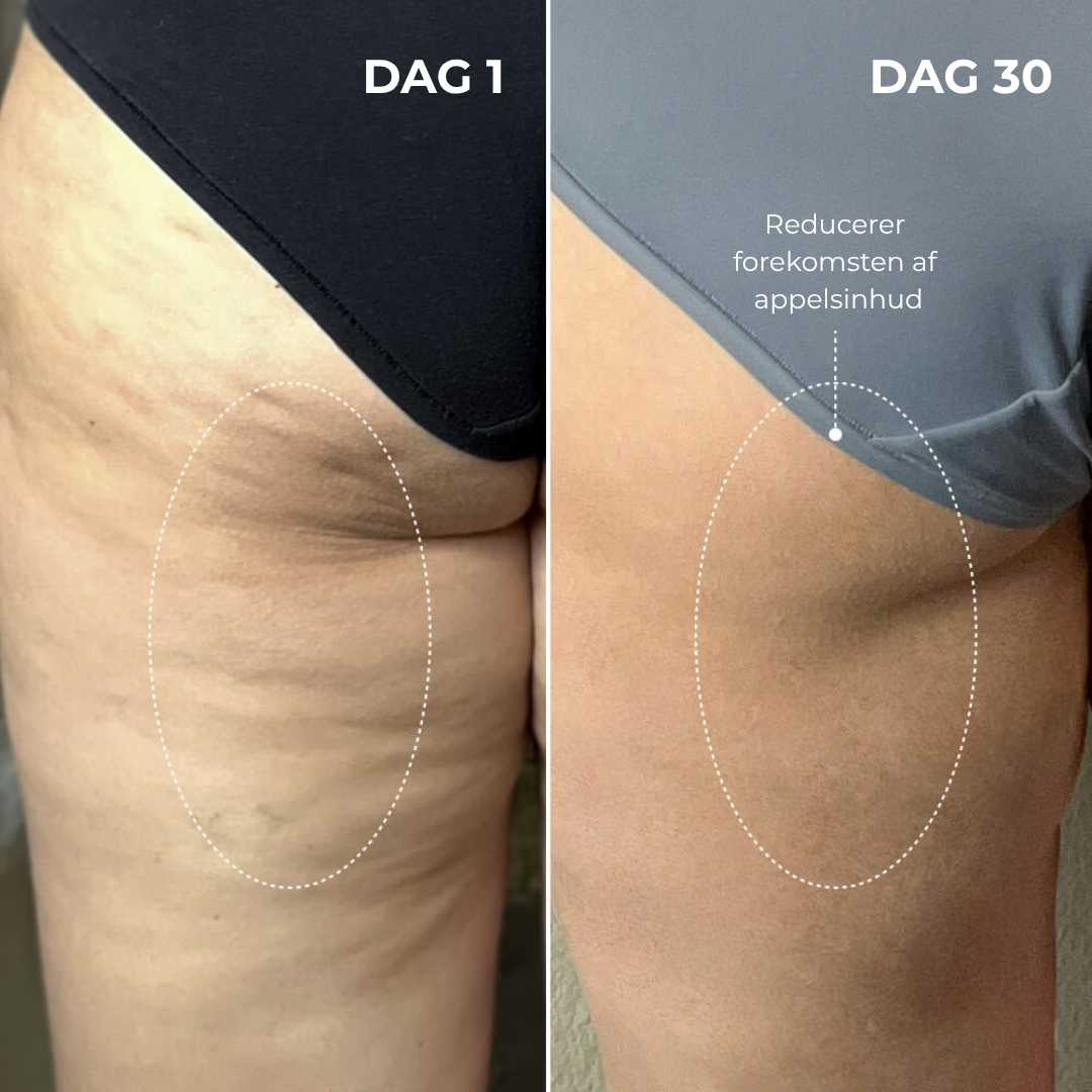 DermaLøft™ Opstrammende Numsemaske - Løfter og former bagdelen, mindsker appelsinhud og efterlader huden glat, fast og silkeblød