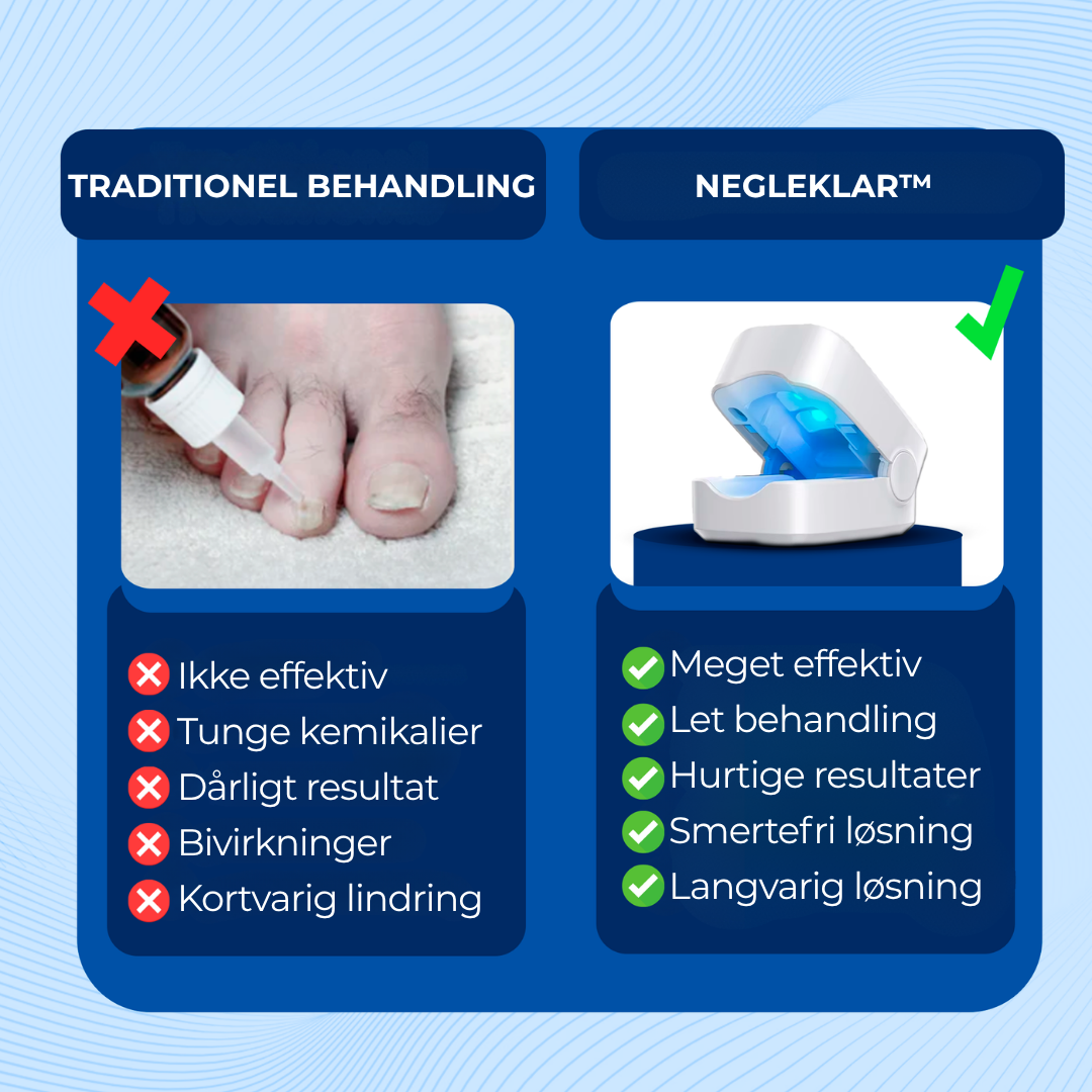 NegleFri™ | UV-laser mod neglesvamp | Klinisk bevist teknologi der bekæmper svampen ved kilden