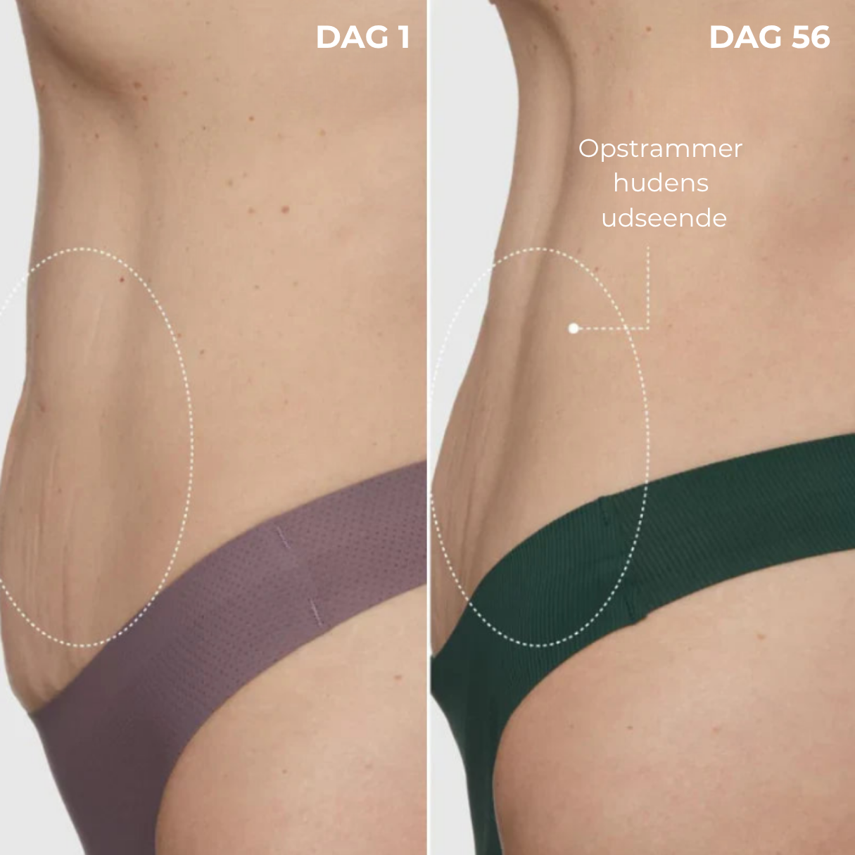 SleepShape™ - Luksuriøs kropswhip – for en fastere og glattere silhuet natten over