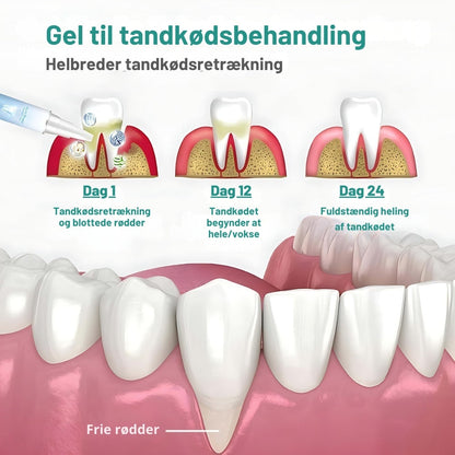 Oralis™ Tandgel – Gendan dit tandkød & få sundere, hvidere tænder på 7 dage