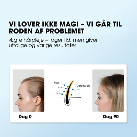 ThickStart™ – Roll-on til synligt tættere hår