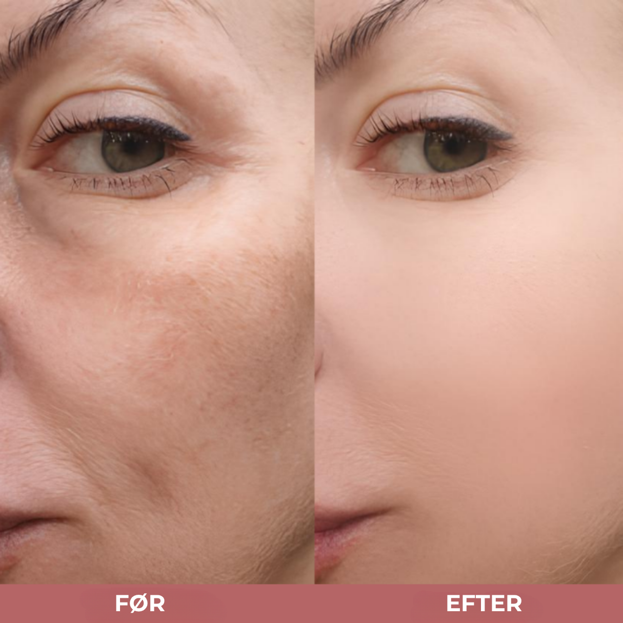 CC Beauty Peel Shot – Duo med Glow Rice Ampuller