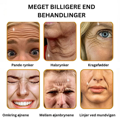 BOTOX™ Anti-rynke creme