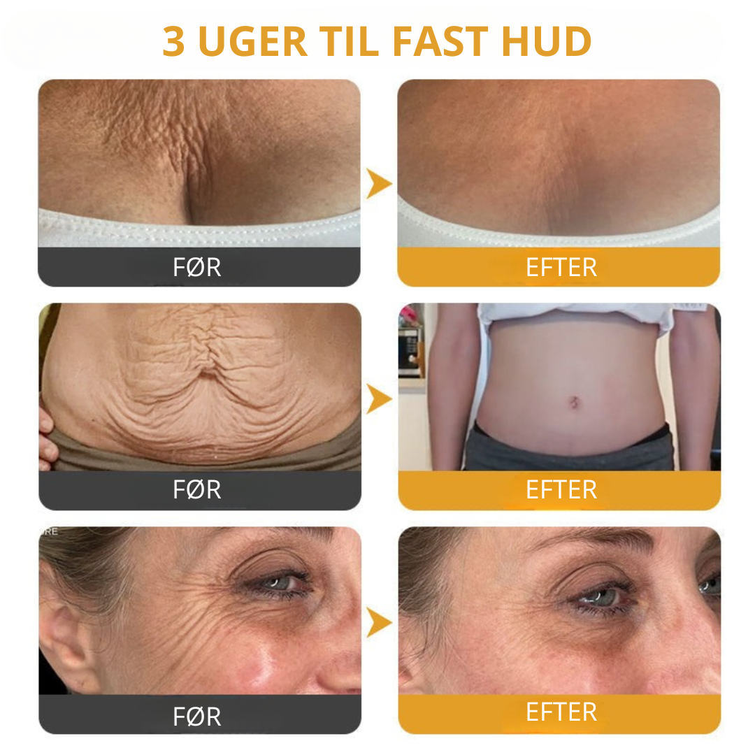 Venomé™| Botox Rynkeopstrammende Creme