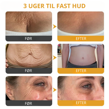 Venomé™| Botox Rynkeopstrammende Creme