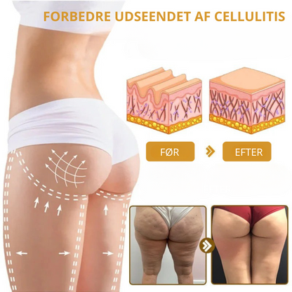Venomé™| Botox Rynkeopstrammende Creme