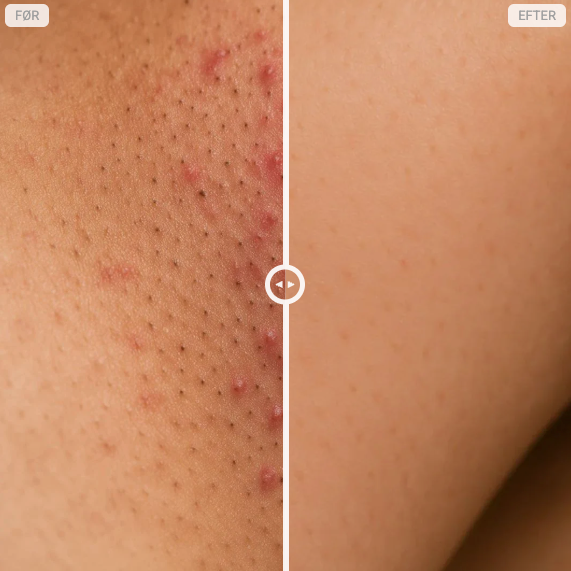 Glathud - Hårfjerningsolie – Naturligt glat hud uden barbering