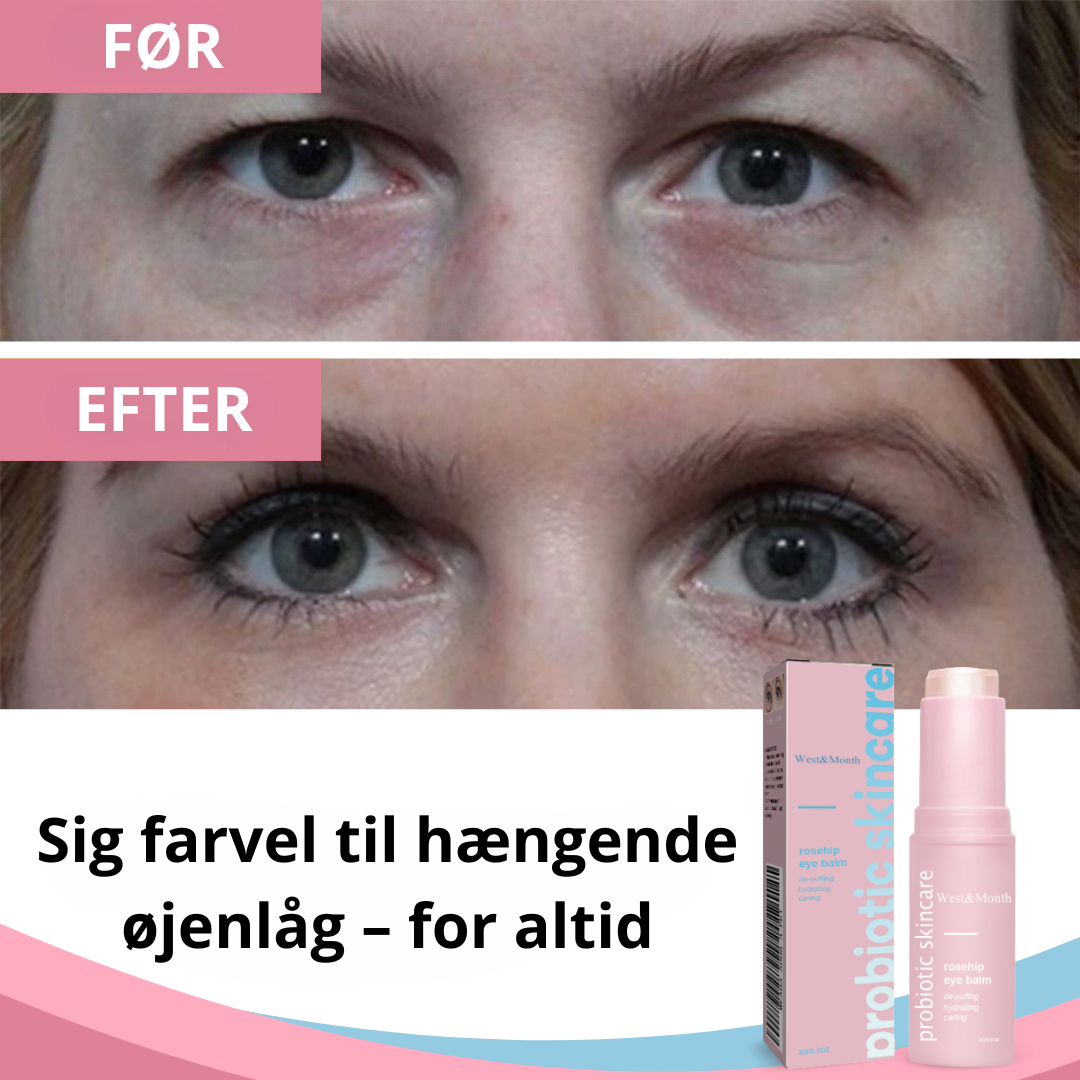 LidGlow™ | Få 87 % strammere, løftede øjenlåg på kun 2 timer