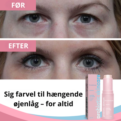 LidGlow™ | Få 87 % strammere, løftede øjenlåg på kun 2 timer