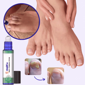 NailFix | Eliminer neglesvamp på kun 5 dage!