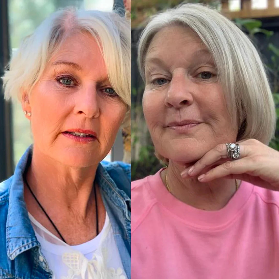 HairBoost™ – Slut med hårtab, få fyldigt hår igen