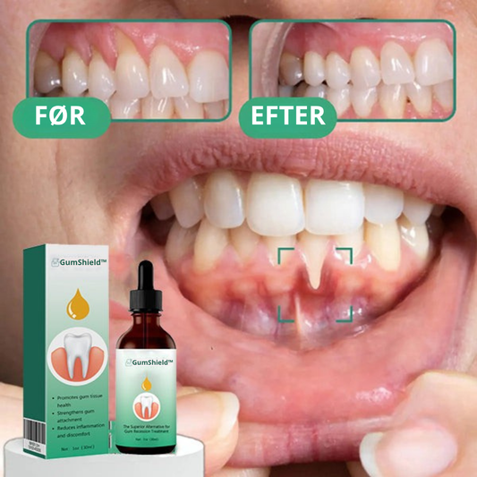 GumShield™ | Genopretter vigende tandkød i 93% af tilfældene inden for 4 dage!