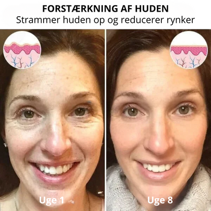 FirmSkin™ | Botox Ansigtsserum